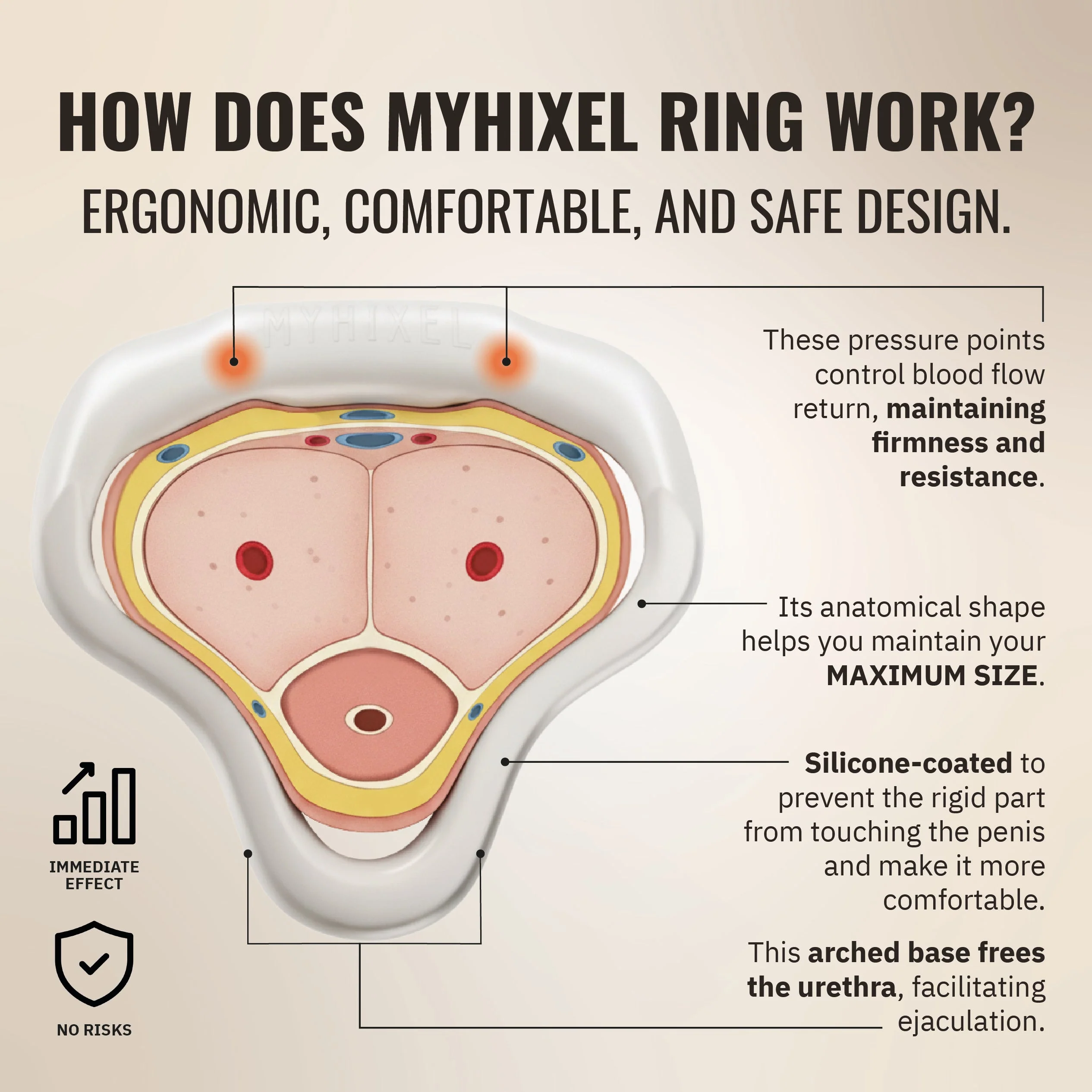 MYHIXEL Ring - Image 2